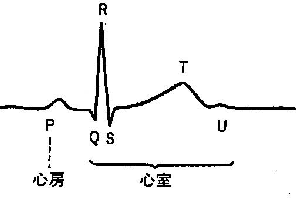 \includegraphics[width=.6\linewidth]{hakei.eps}